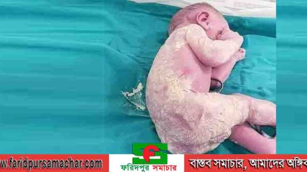 ভারনিক্স নামক শব্দটির সঙ্গে আমরা কতটা পরিচিত