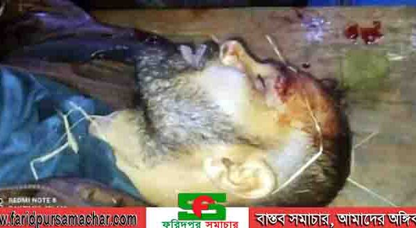 চরভদ্রাসনে ৪ ডাকাতকে কুপিয়ে জখম